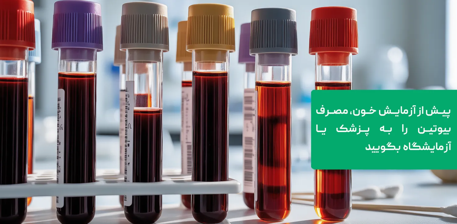 آزمایش تیروئید و هورمون
