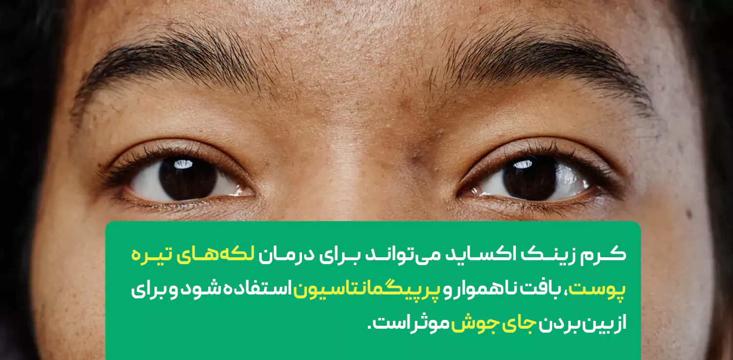 کرم زینک اکساید برای درمان بیماری های پوستی موثر است.