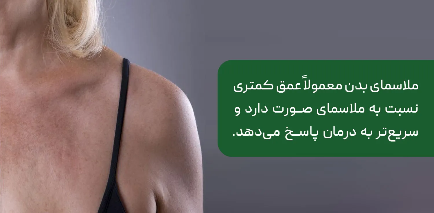 ملاسما بدن