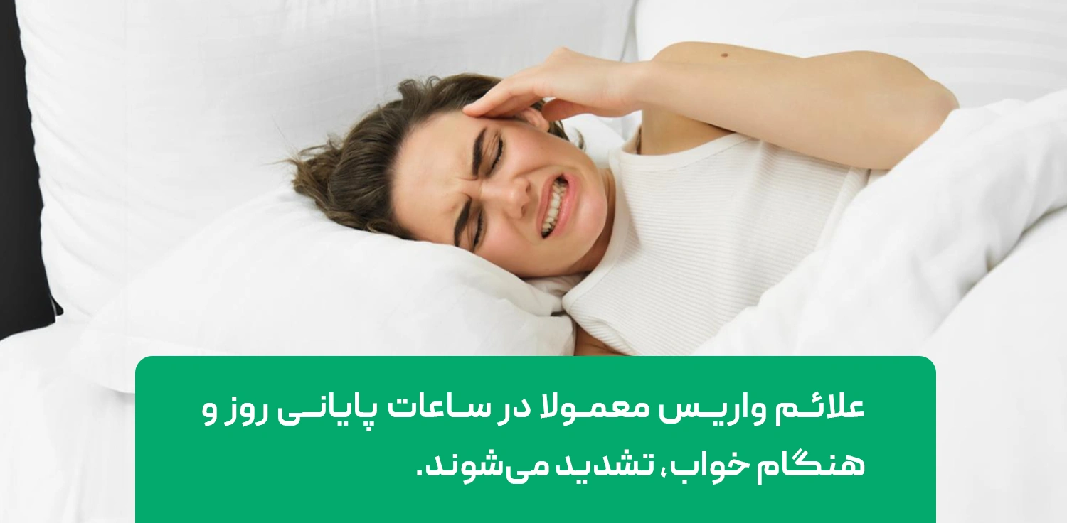 تشدید علائم واریس در انتهای روز
