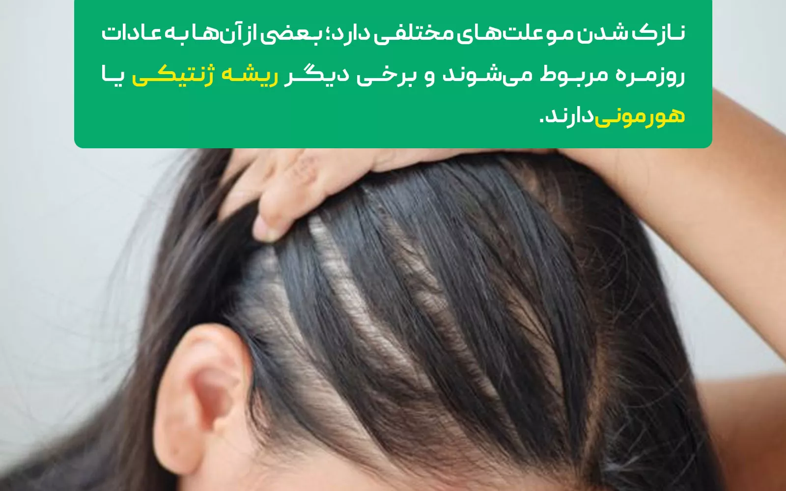 چرا موهایمان نازکک میشود؟