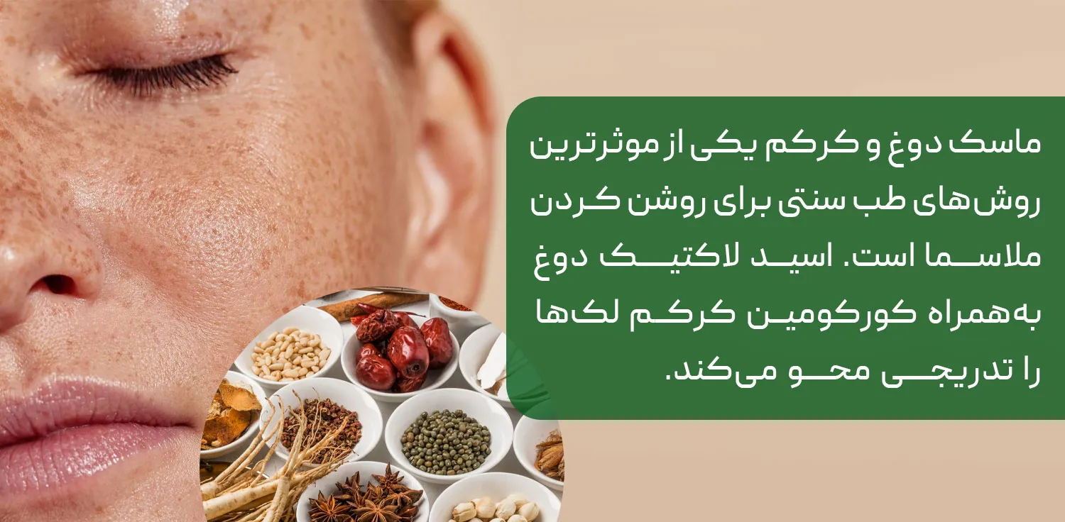 درمان لک بارداری در طب سنتی