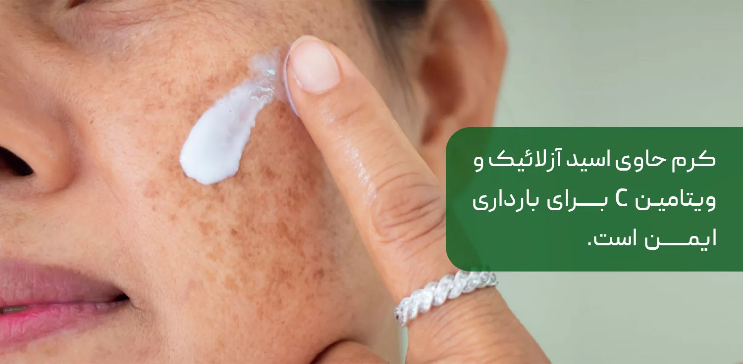 بهترین کرم برای از بین بردن لک بارداری