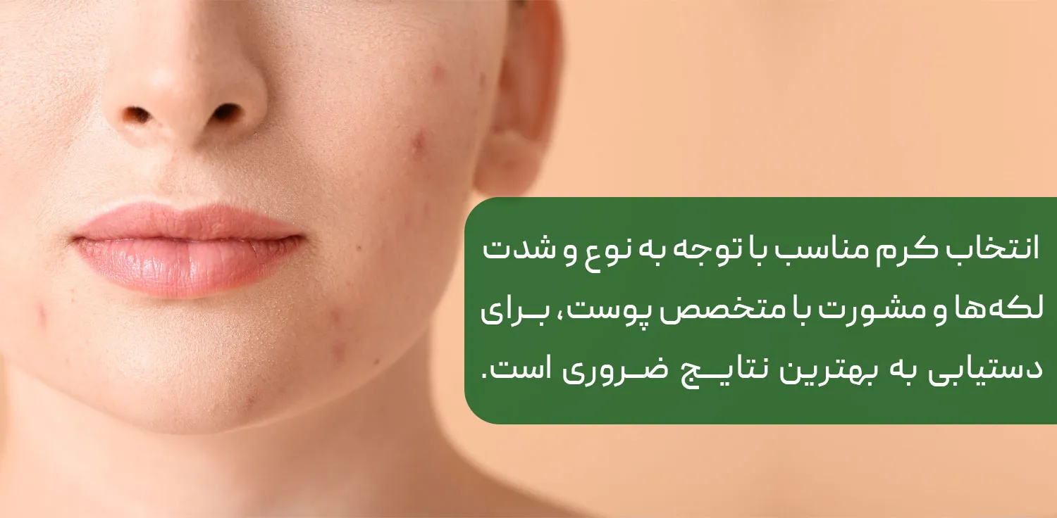 بهترین کرم ابرسان ضد لک صورت