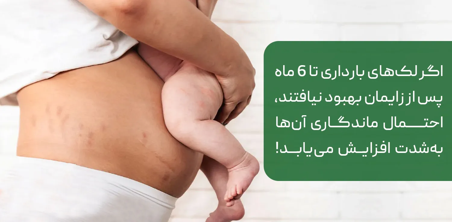 ملاسما حاملگی