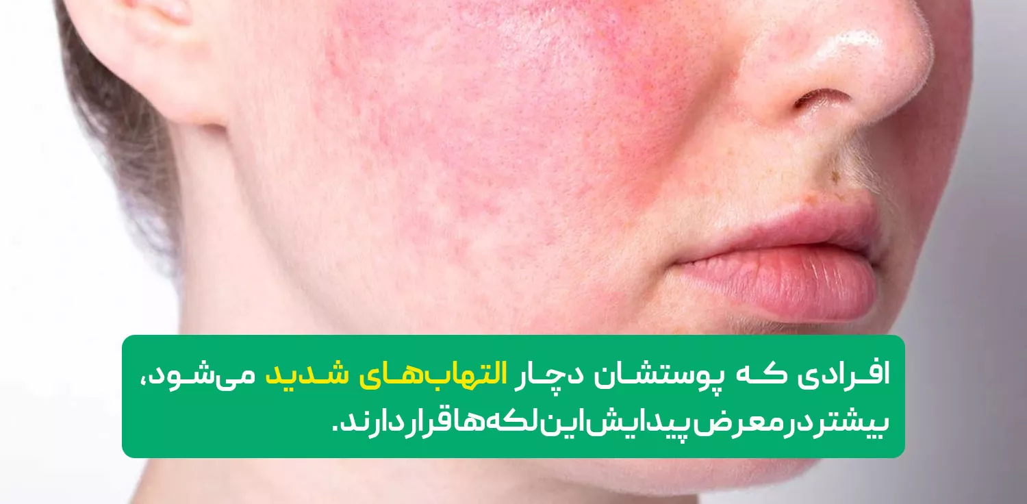 التهاب‌های شدید پوستی