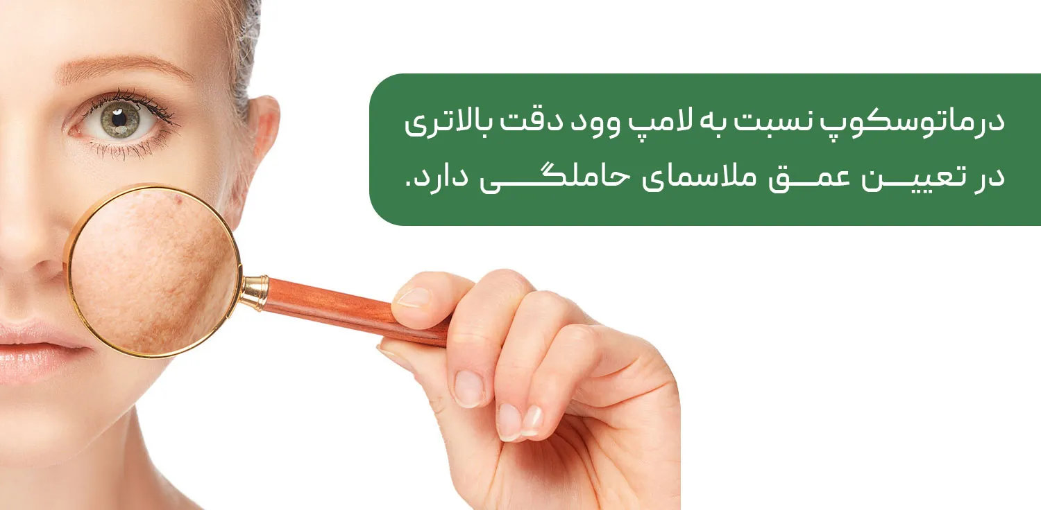 تشخیص ملاسما در بارداری