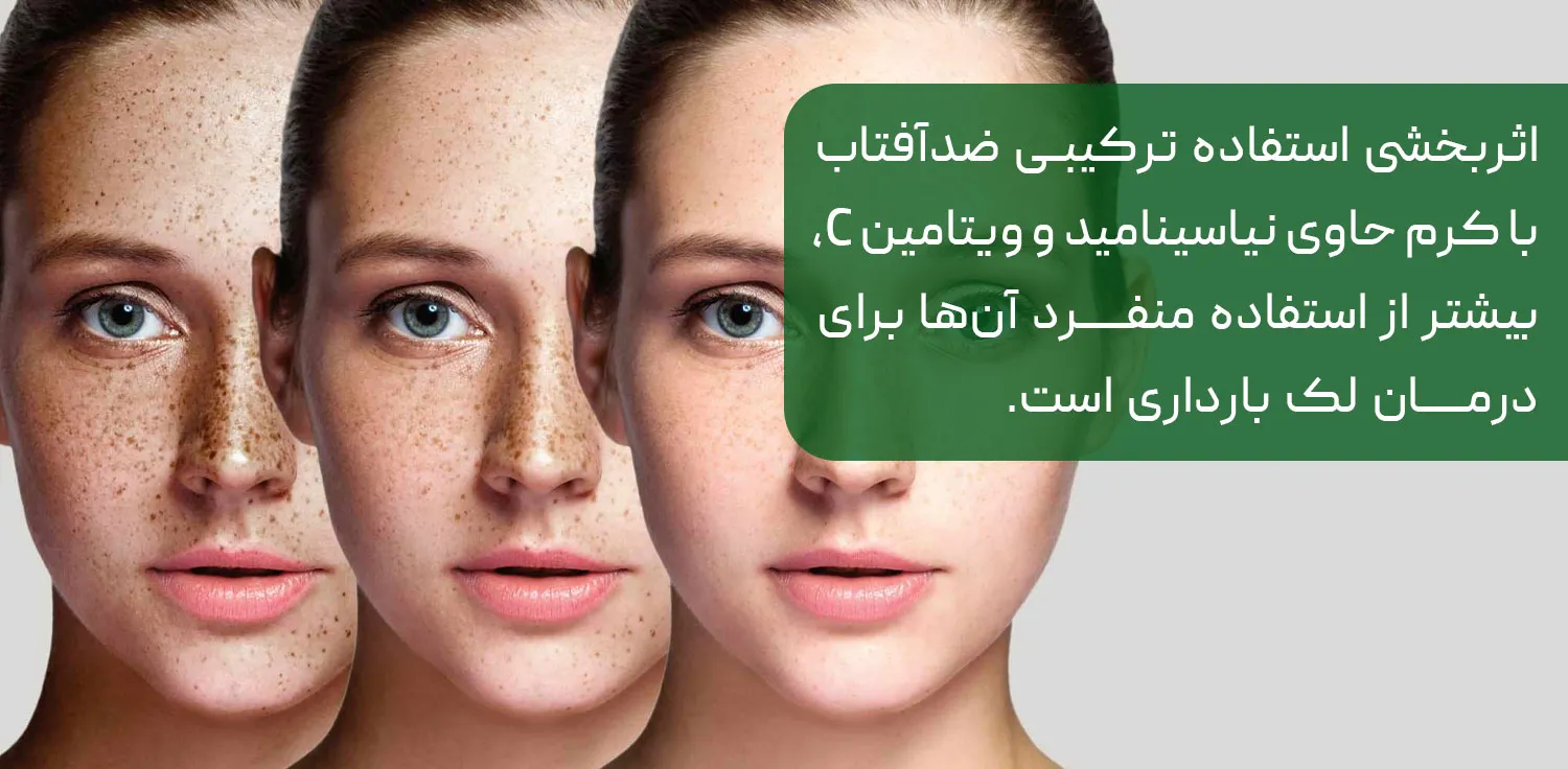 بهترین روش از بین بردن لک حاملگی