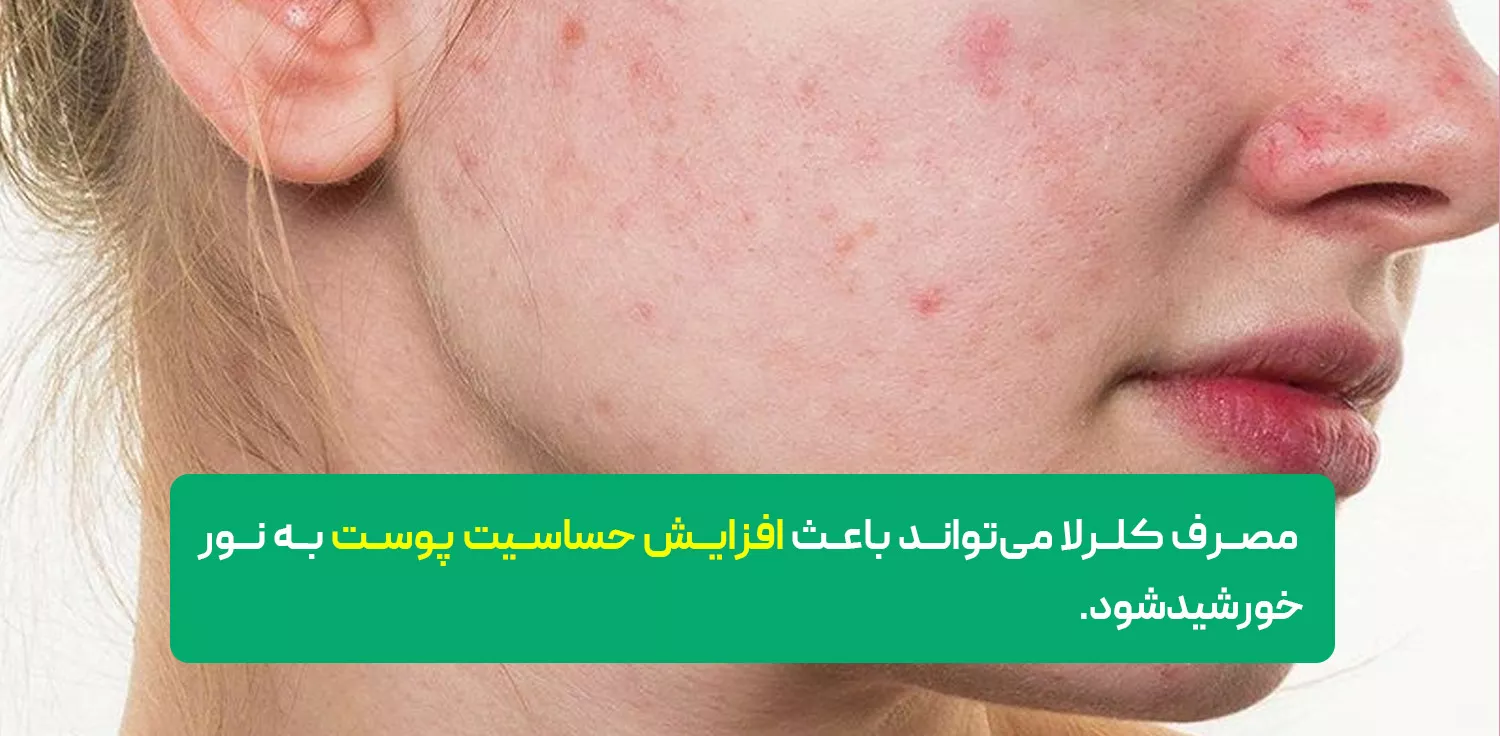 تداخلات دارویی قرص آلگومد