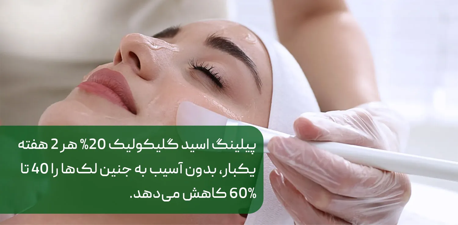 پیلینگ شیمیایی