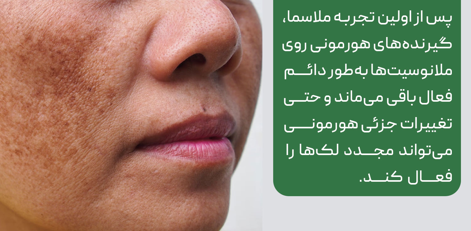 ملاسما حاملگی