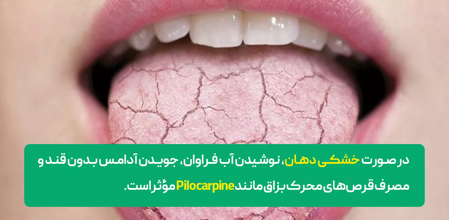 درمان بوی بد دهان با منشاء دهانی