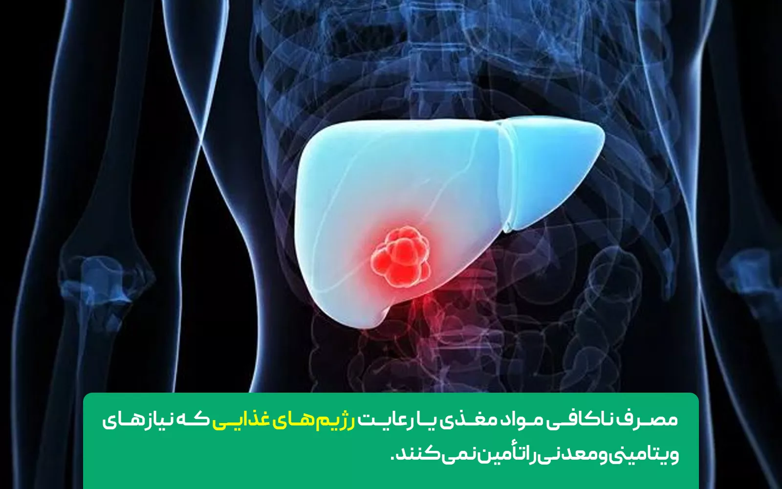 چه عواملی می‌توانند موجب اسپاسم عضلانی شوند؟