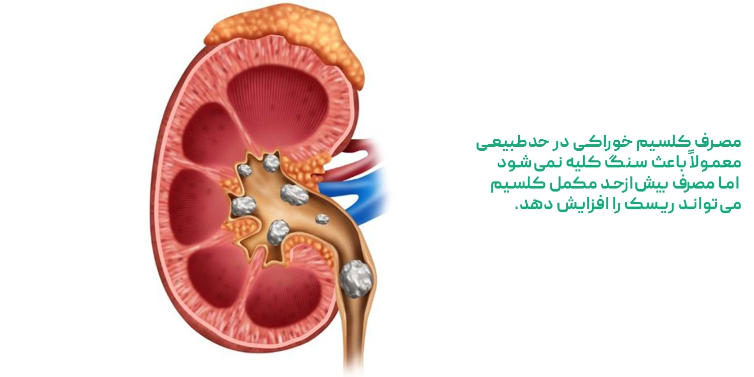 آیا مصرف کلسیم باعث سنگ کلیه میشود؟