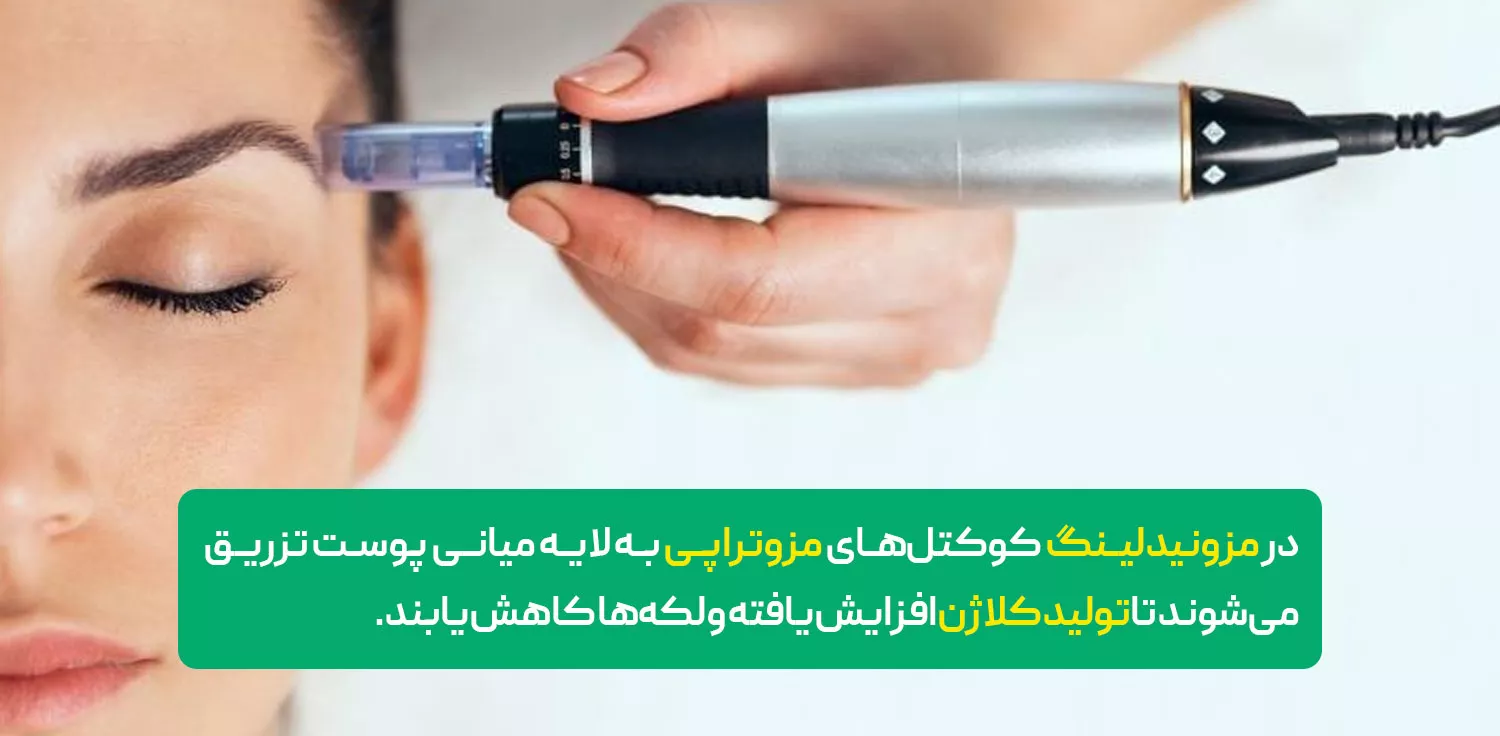 مزونیدلینگ