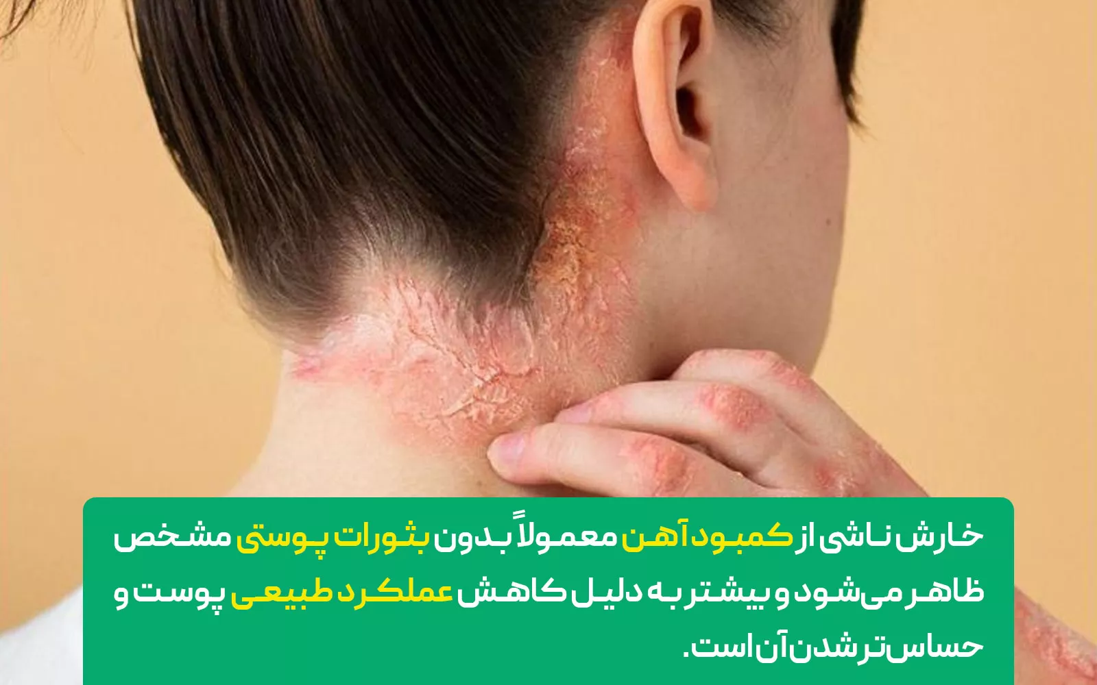 آهن (Iron)