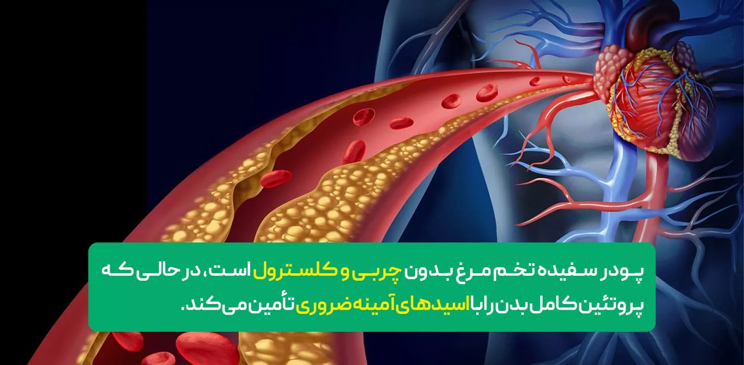فاقد کلسترول و چربی