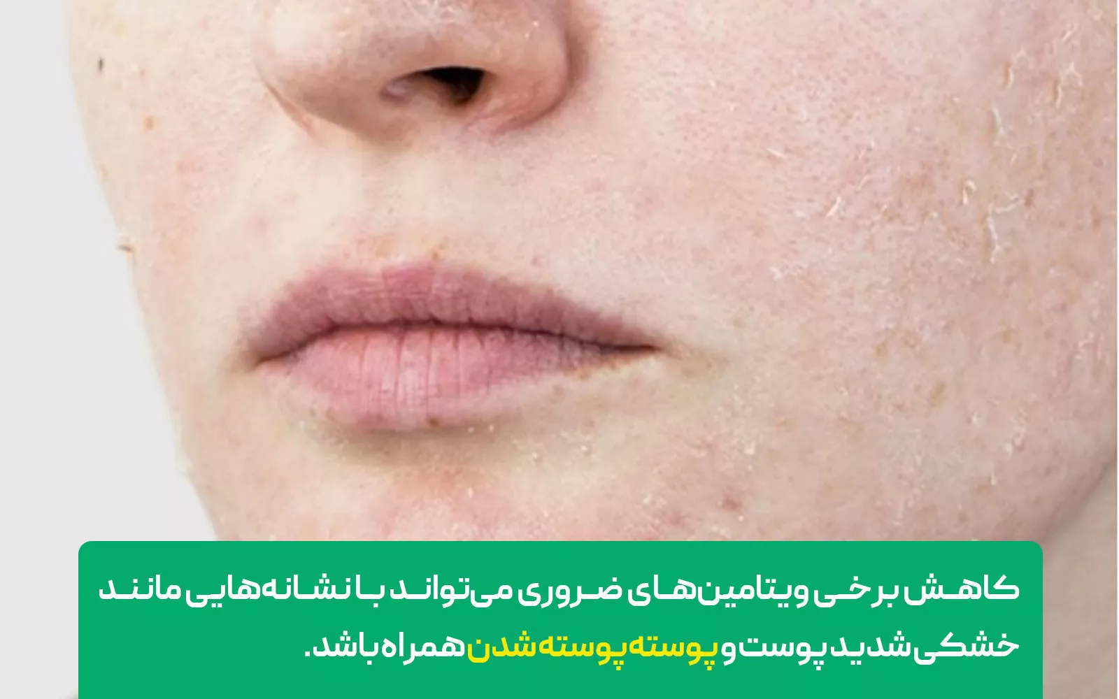 علائم کمبود ویتامین که باعث خارش می&zwnj;شود