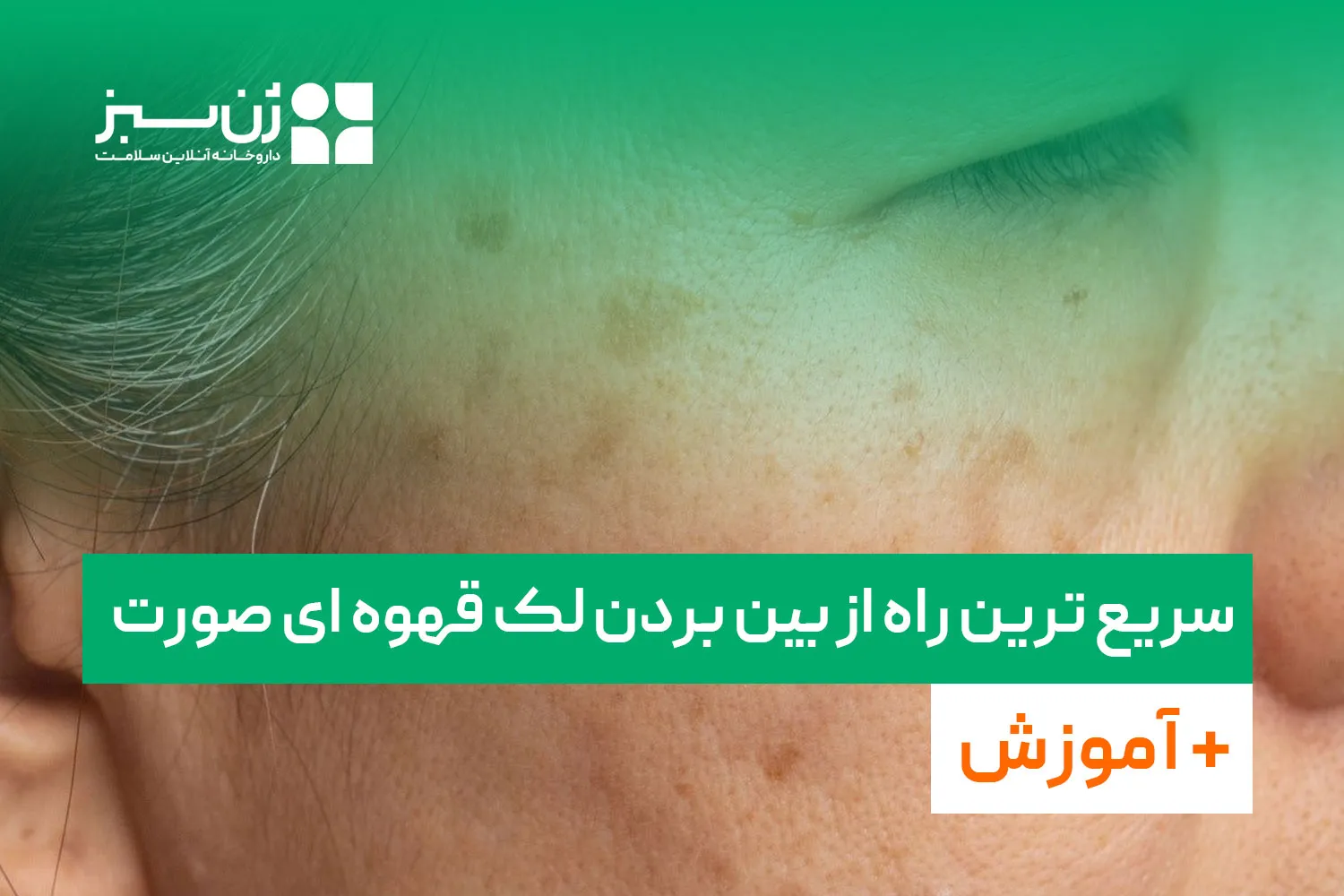 سریع ترین راه از بین بردن لک قهوه ای صورت + آموزش