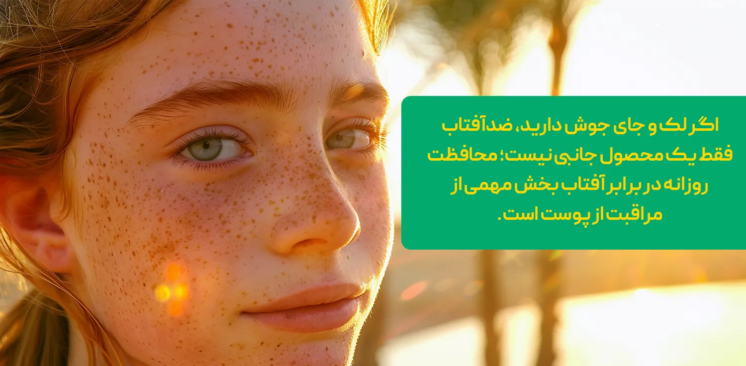 ضد آفتاب