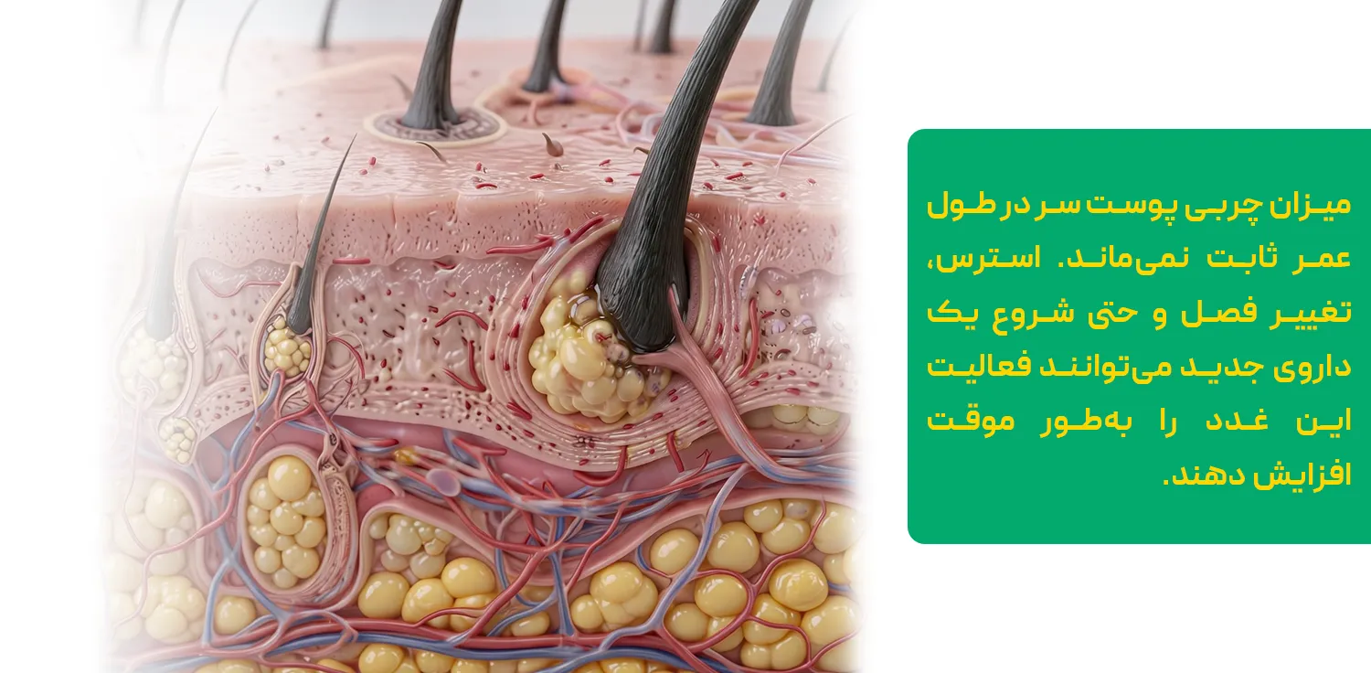 درمان قطعی چربی موی سر