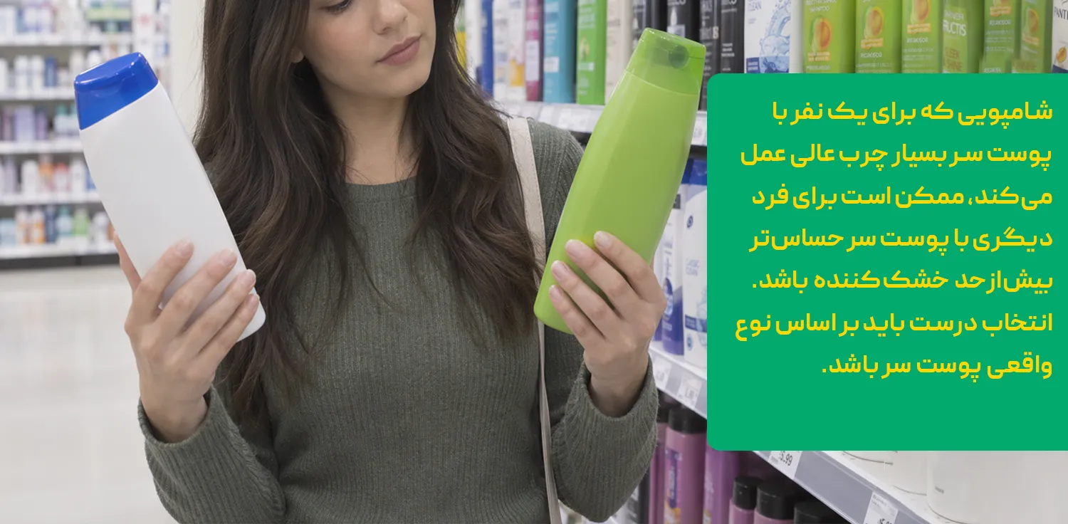 درمان قطعی چربی موی سر