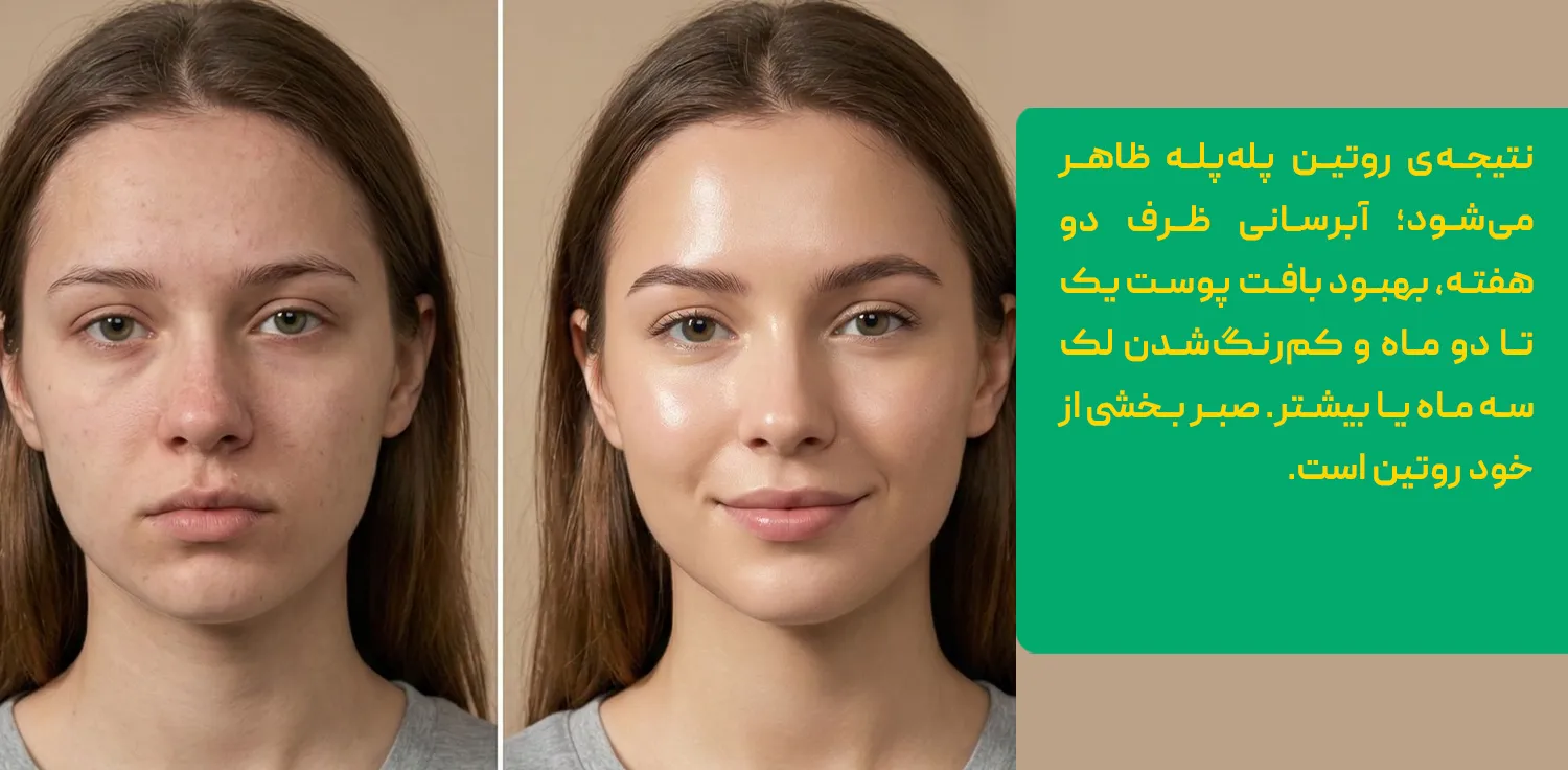 روتین پوستی روتین پوستی