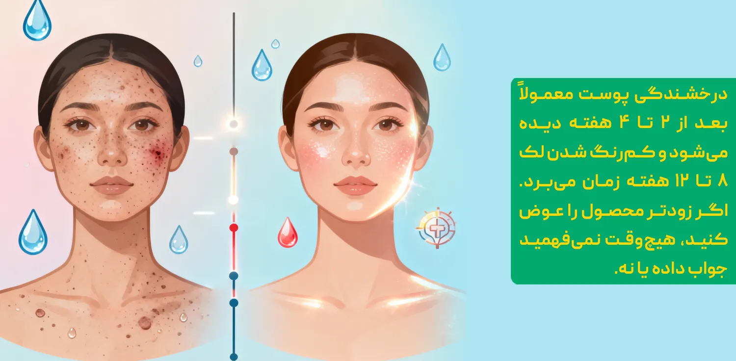 سرم، تونر و قرص ویتامین سی؛ مقایسه برای درمان لک