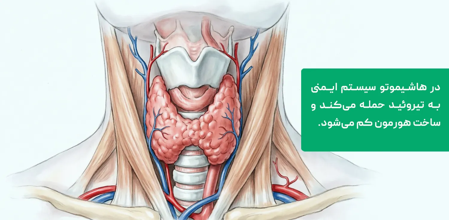 علائم کم کاری تیروئید در زنان