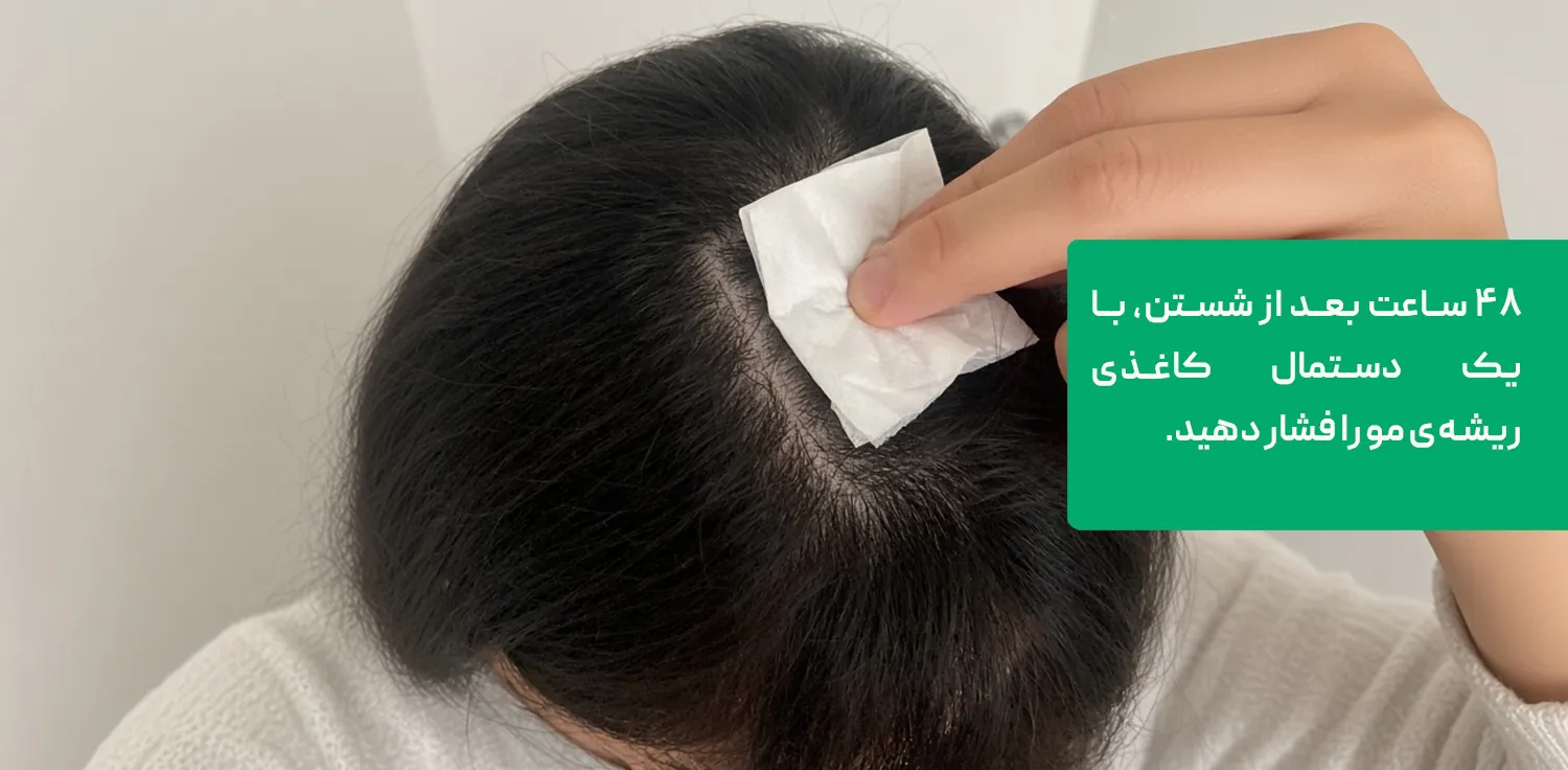 تست تشخیص نوع مو با دستمال کاغذی بعد از ۴۸ ساعت تست تشخیص نوع مو با دستمال کاغذی بعد از ۴۸ ساعت