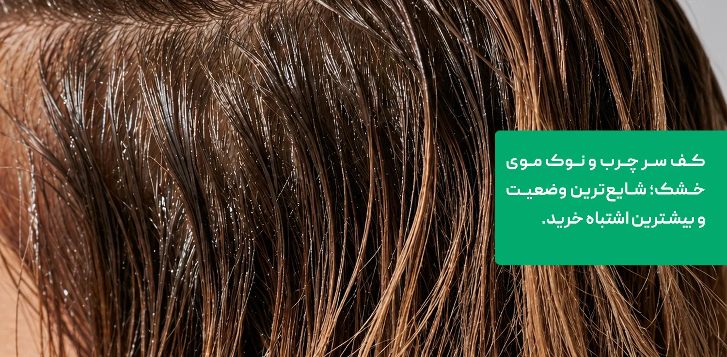 بهترین شامپو برای کف سر چرب و ساقه خشک موهای ترکیبی بهترین شامپو برای کف سر چرب و ساقه خشک موهای ترکیبی
