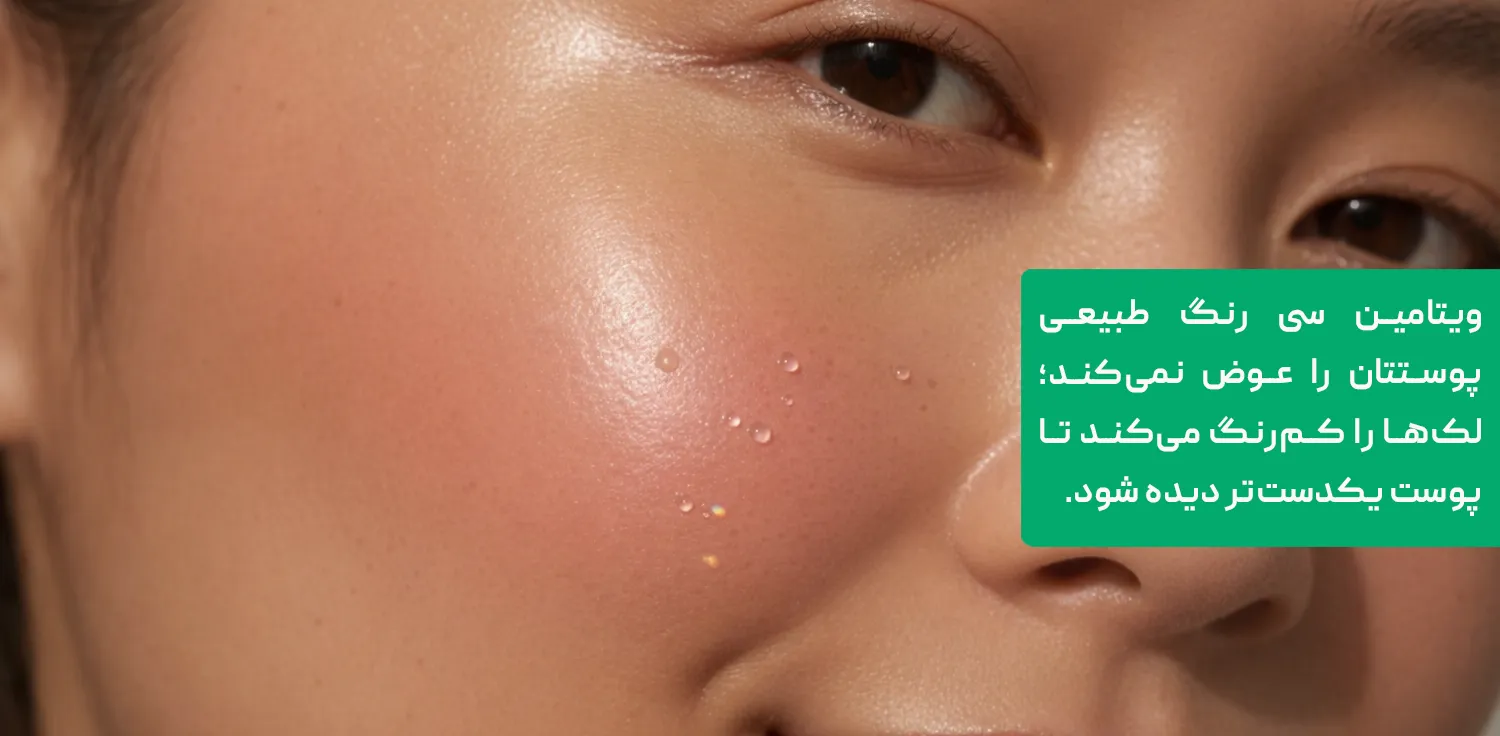 نمای نزدیک پوست صاف و یکدست گونه در نور طبیعی